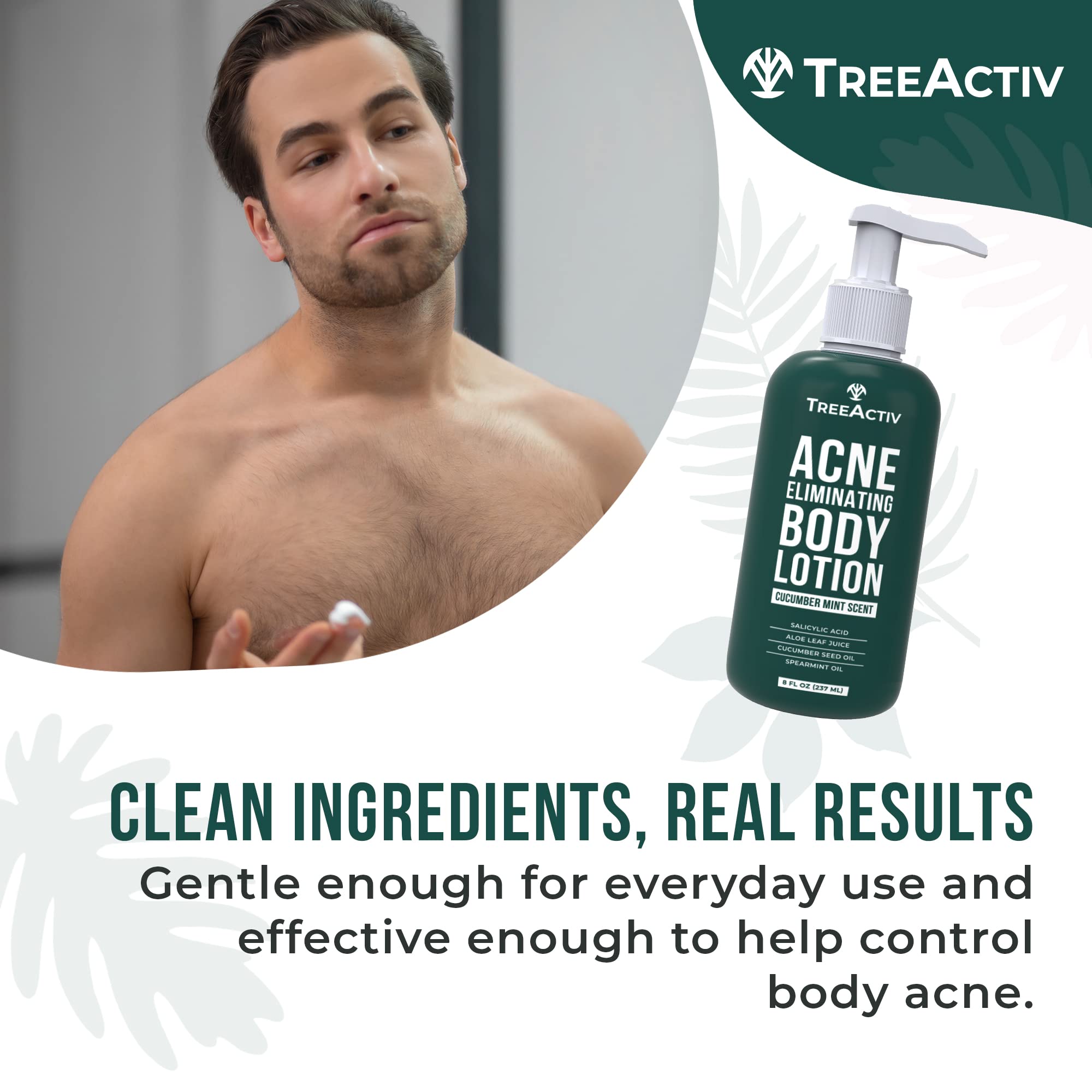 TreeActiv Acne Eliminating Body Lotion 8 oz | Clears Body, Back, Butt & Shoulders | Cucumber Mint