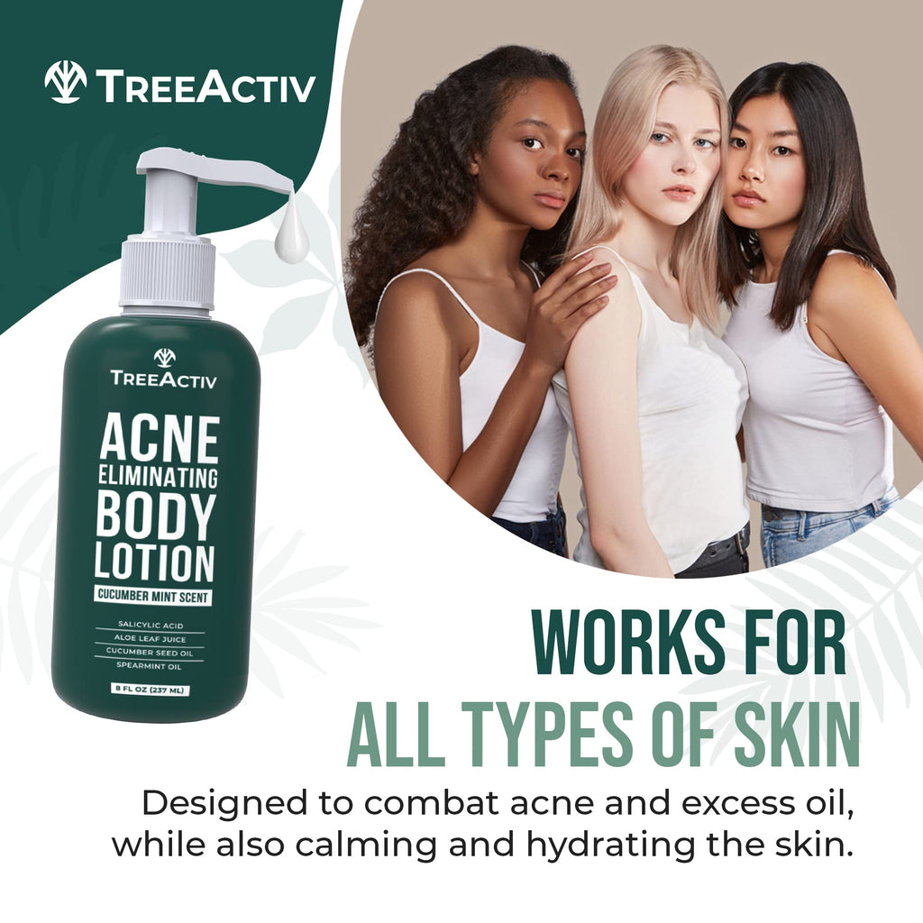 TreeActiv Acne Eliminating Body Lotion 8 oz | Clears Body, Back, Butt & Shoulders | Cucumber Mint