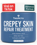 TreeActiv Crepey Skin Repair Cream – Firming Hyaluronic Acid Lotion (8 oz)
