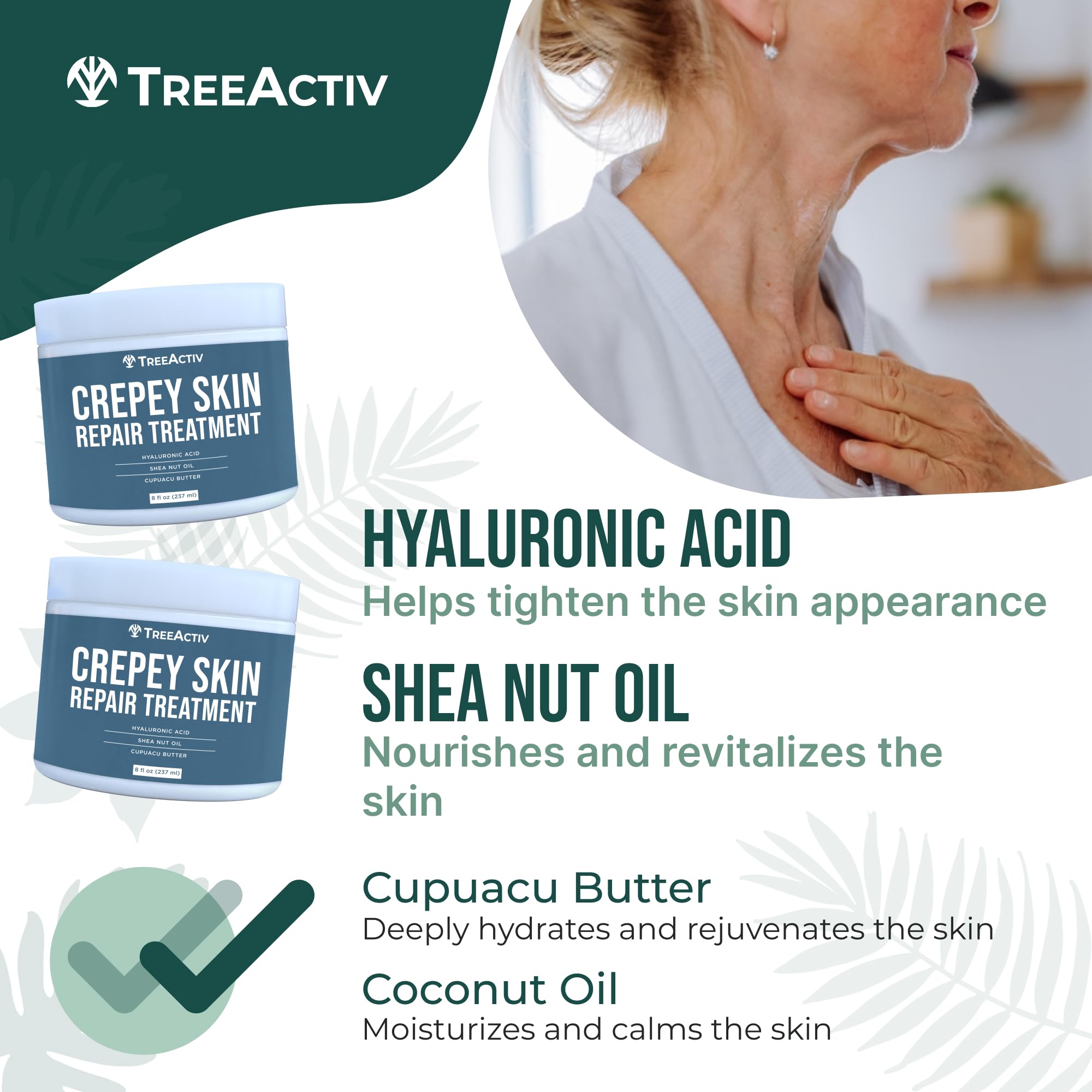 TreeActiv Crepey Skin Repair Cream – Firming Hyaluronic Acid Lotion (8 oz)