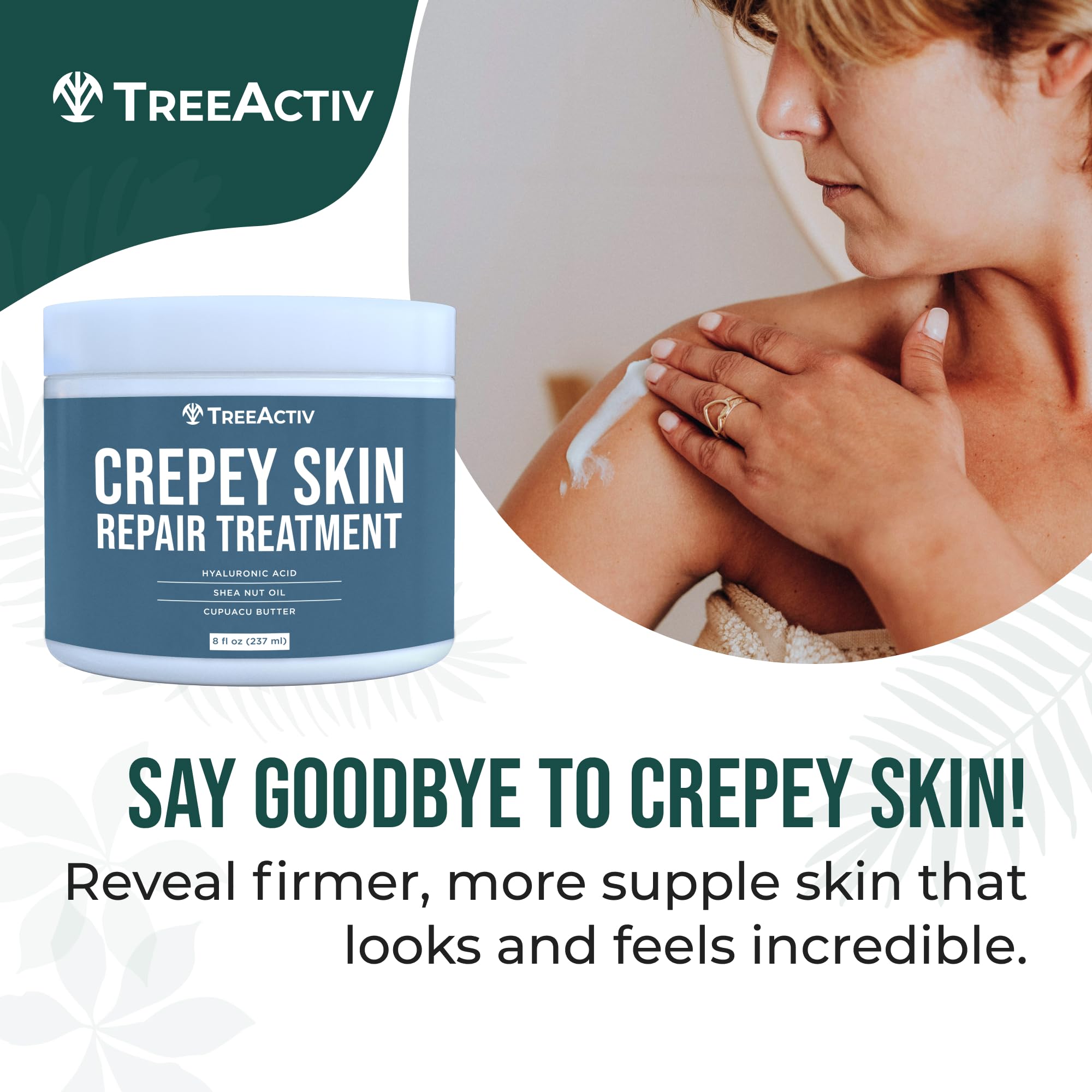 TreeActiv Crepey Skin Repair Cream – Firming Hyaluronic Acid Lotion (8 oz)