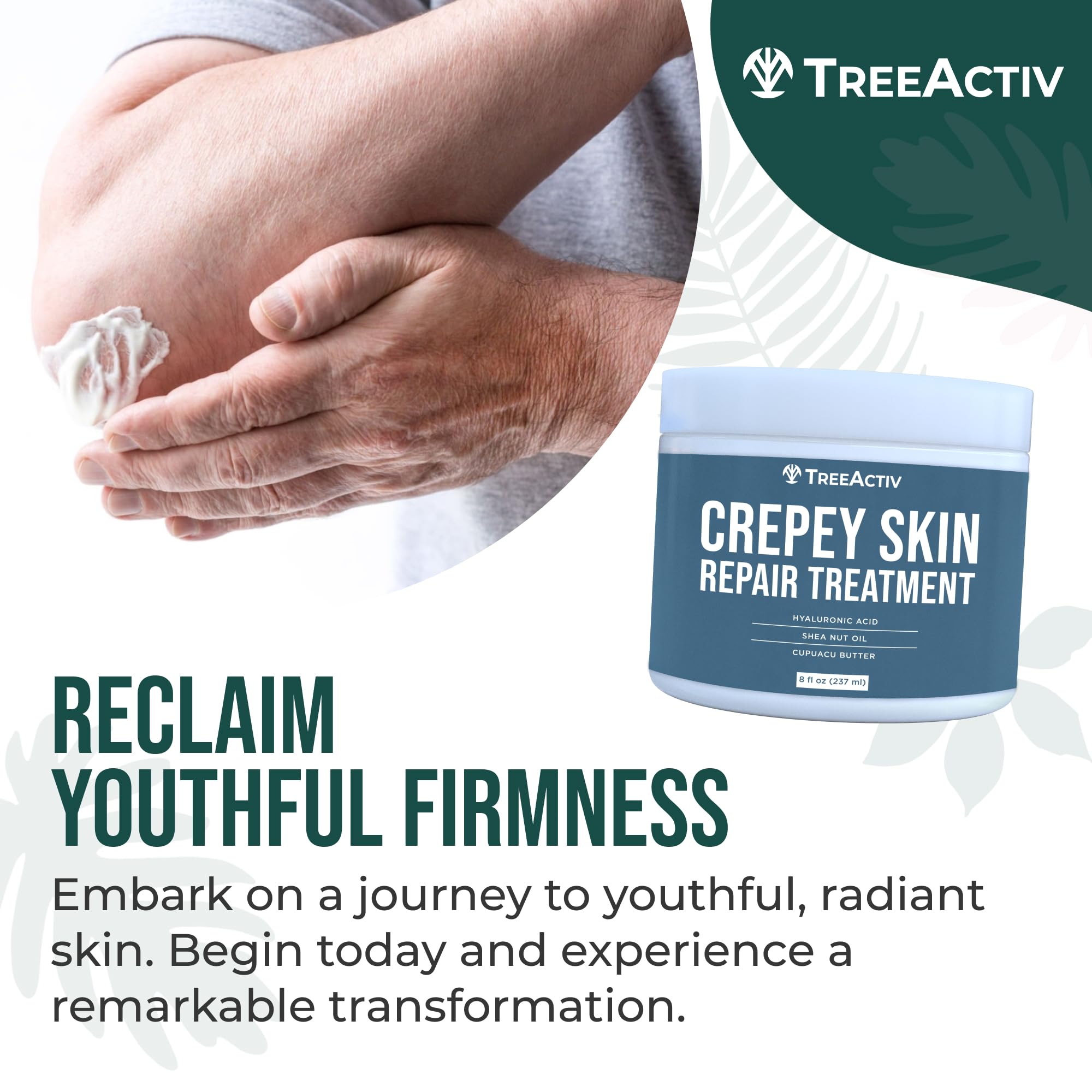 TreeActiv Crepey Skin Repair Cream – Firming Hyaluronic Acid Lotion (8 oz)