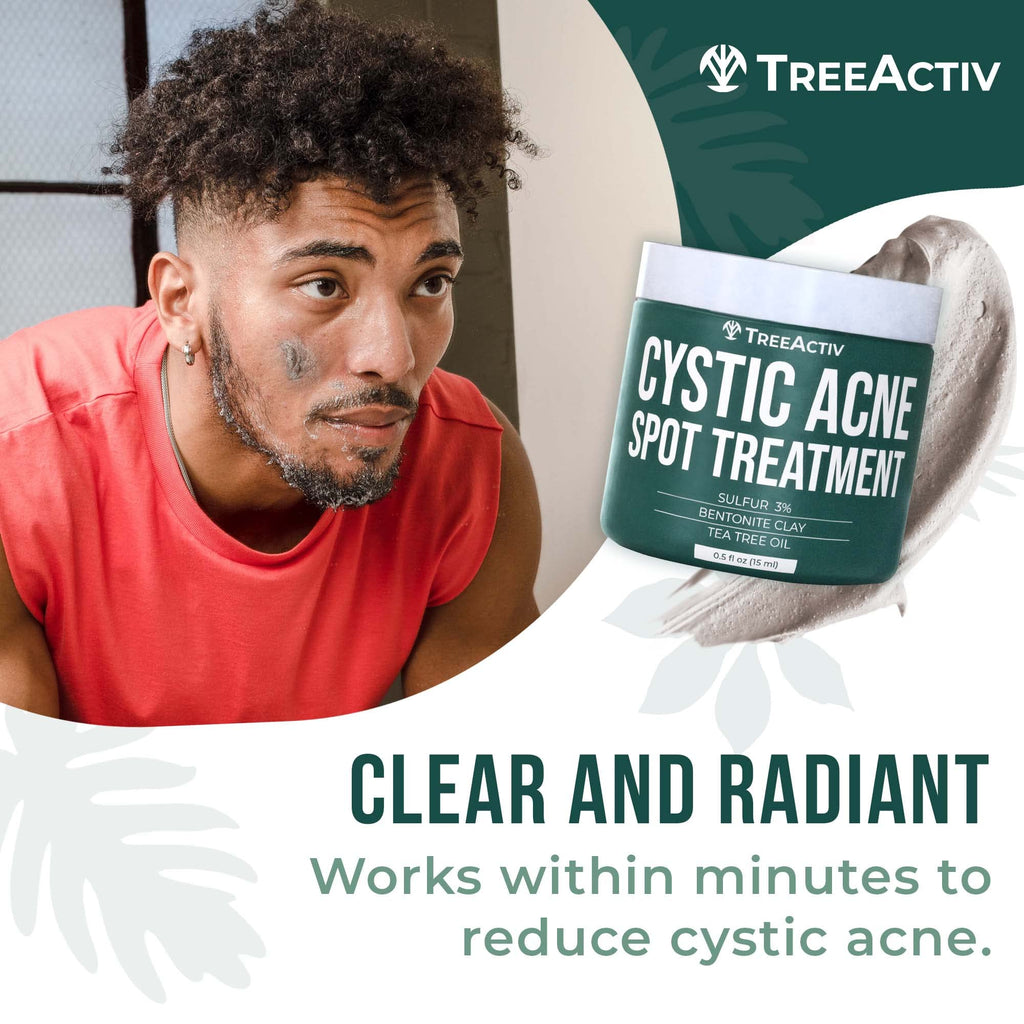 TreeActiv Cystic Acne Spot Treatment – Overnight Sulfur & Bentonite Clay for Face & Body • 0.5oz