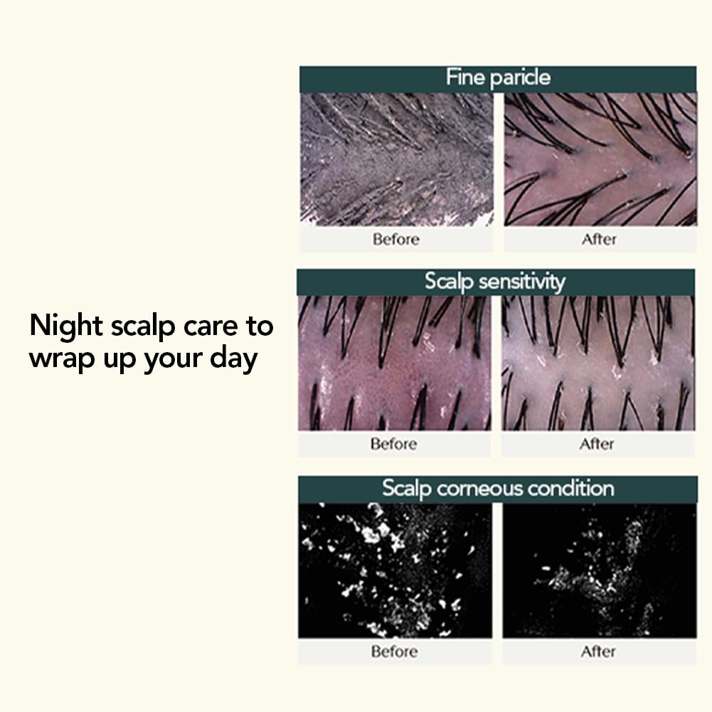 TREECELL Night Collagen Shampoo – Midnight Forest, 12.2 fl oz | Deep Cleansing, Overnight Hydration & Low-Molecular Collagen