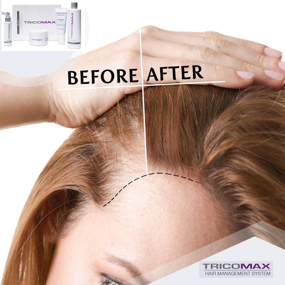 Tricomax Hair Growth Vitamins for Women & Men – Biotin & Saw Palmetto