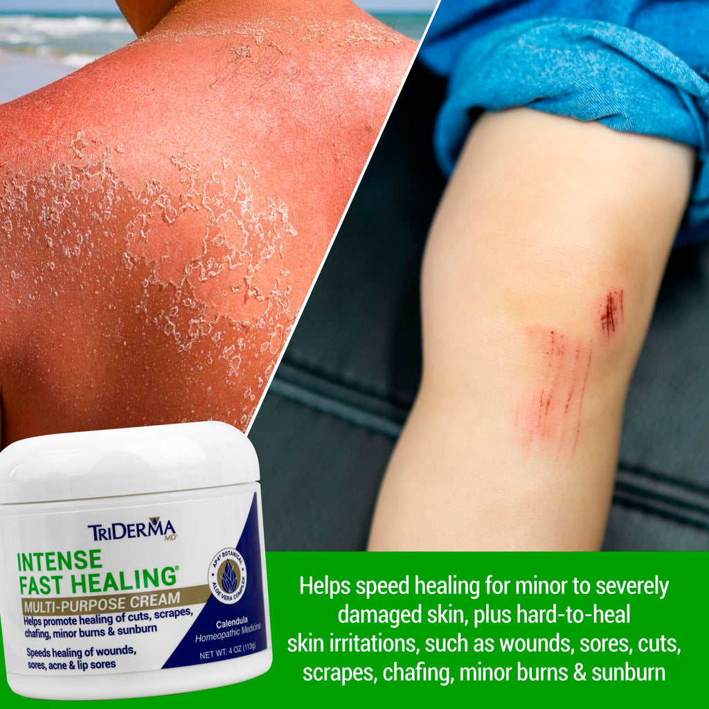 TriDerma Intense Fast Healing Cream – 4 oz for Minor Irritations, Rashes, Scrapes & Cuts