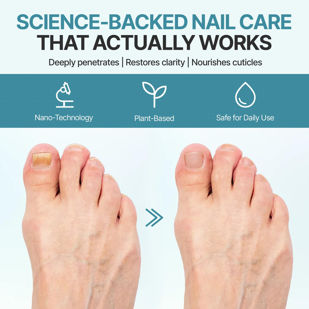 Triple Clear HF Nano Nail Strengthener Oil - Plant-Based Nail Therapy for Damaged Nails (0.5 fl oz)