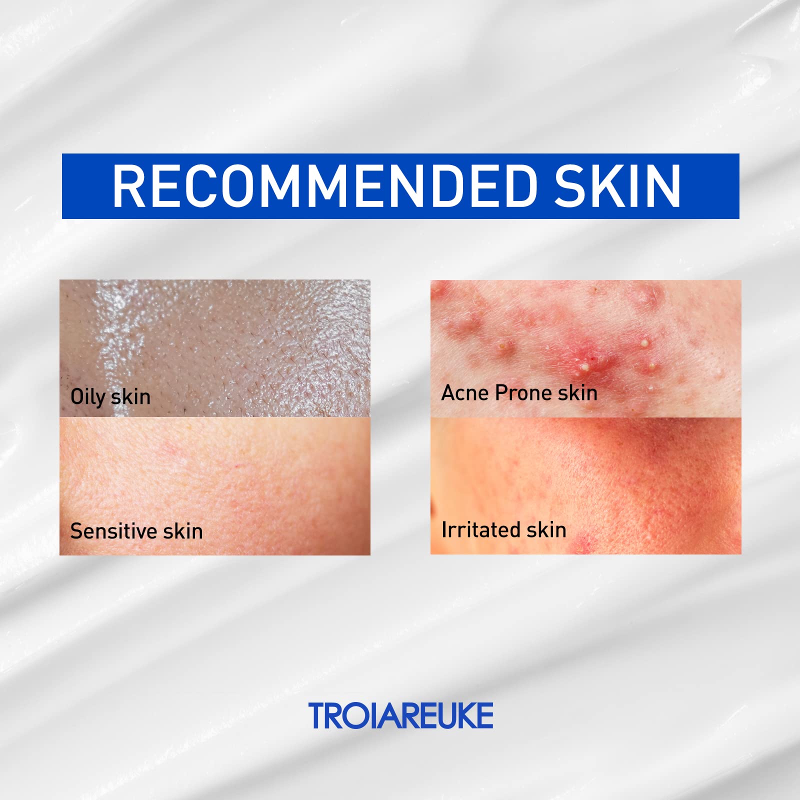 TROIAREUKE ACSEN Recovery Cream | Hydrating, Soothing Facial Moisturizer – Centella Asiatica