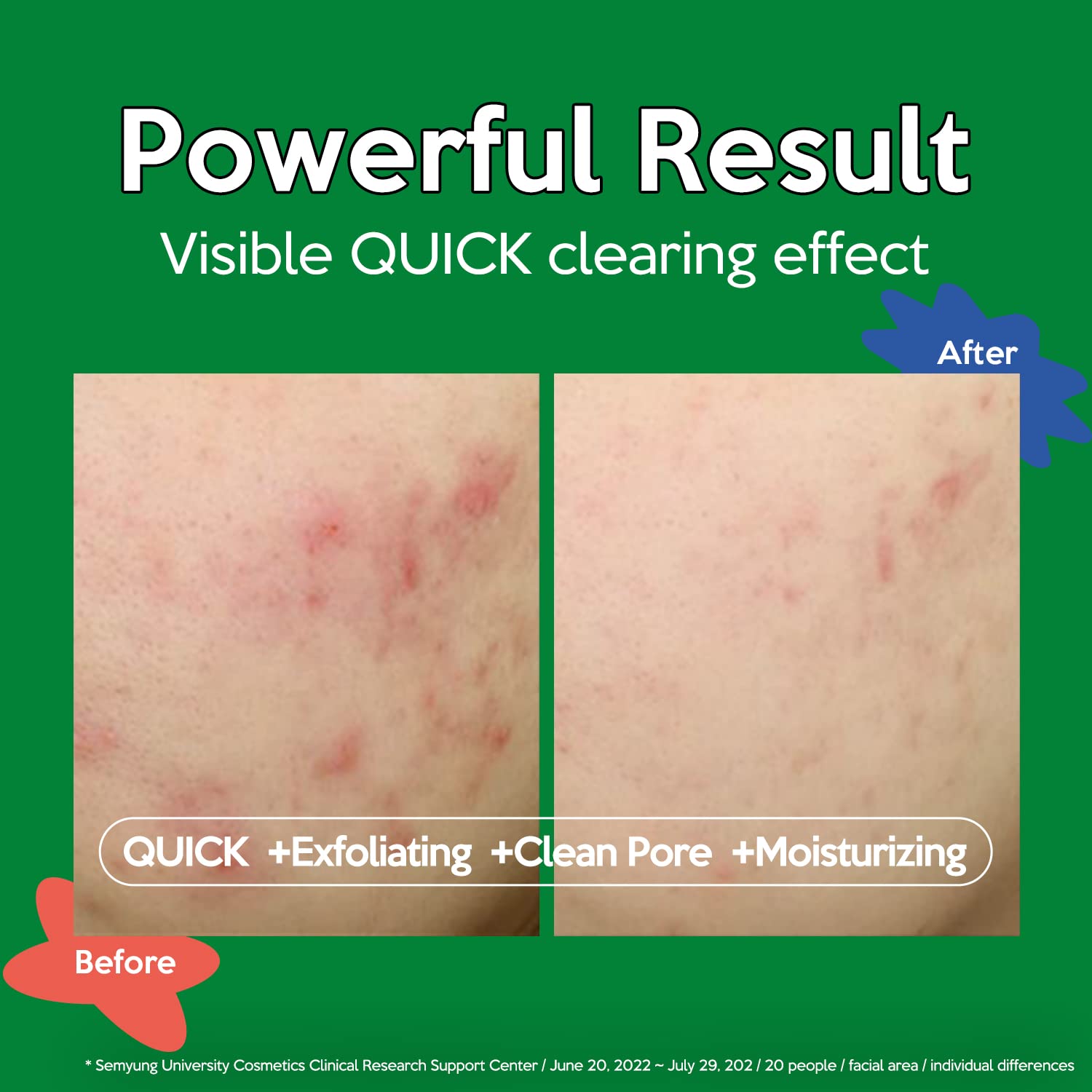 Troubless Clear Toner Pad for Face | Gentle Peeling & Soothing Tea Tree, 60 Pads