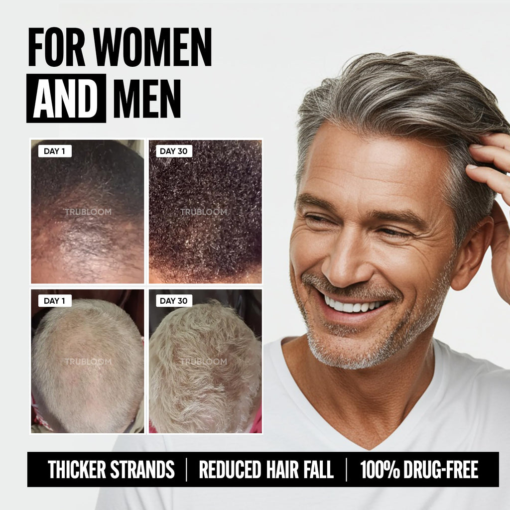 Tru Bloom Hair Growth Vitamins – 1 Month Supply | Fuller, Thicker Hair (Drug-Free)