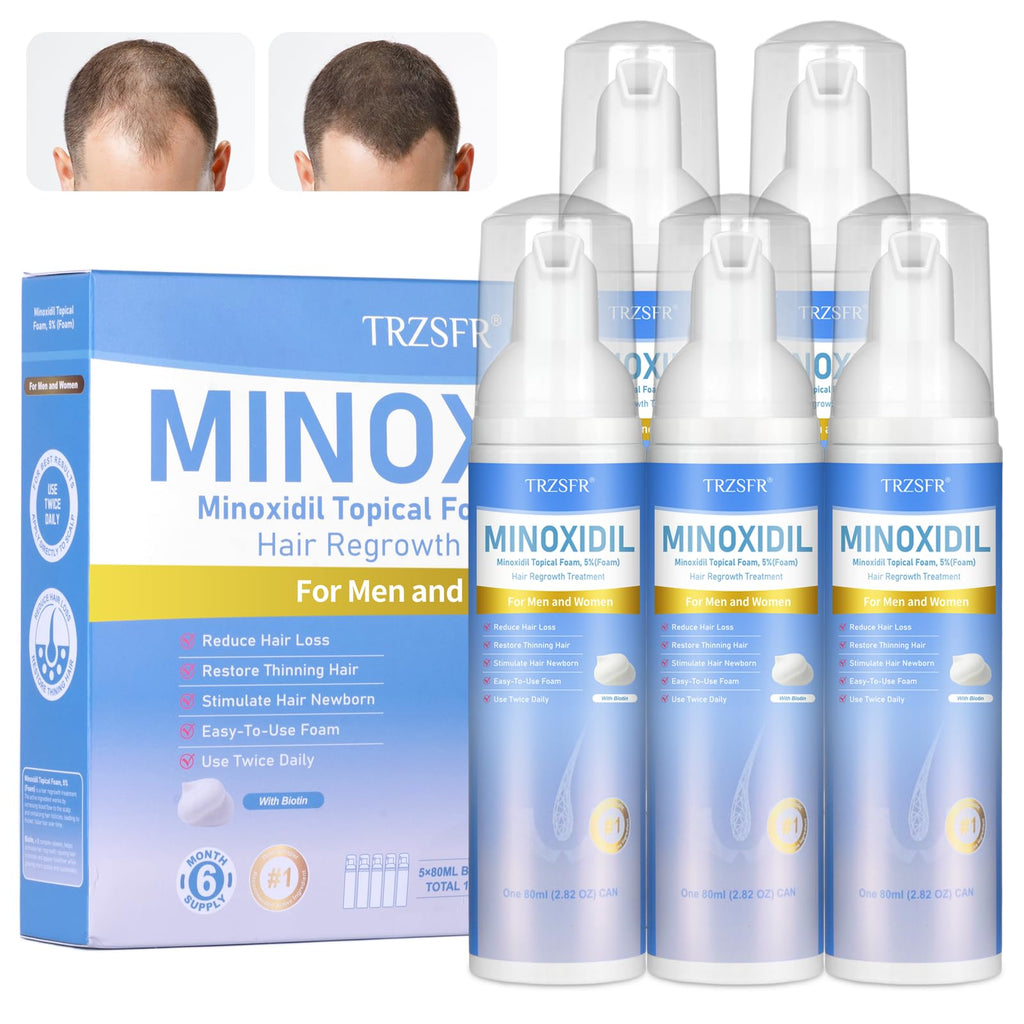 Trzsfr 5% Minoxidil Foam for Men & Women – Hair Regrowth, Non-Greasy, 6-Month Supply (14 oz Total)