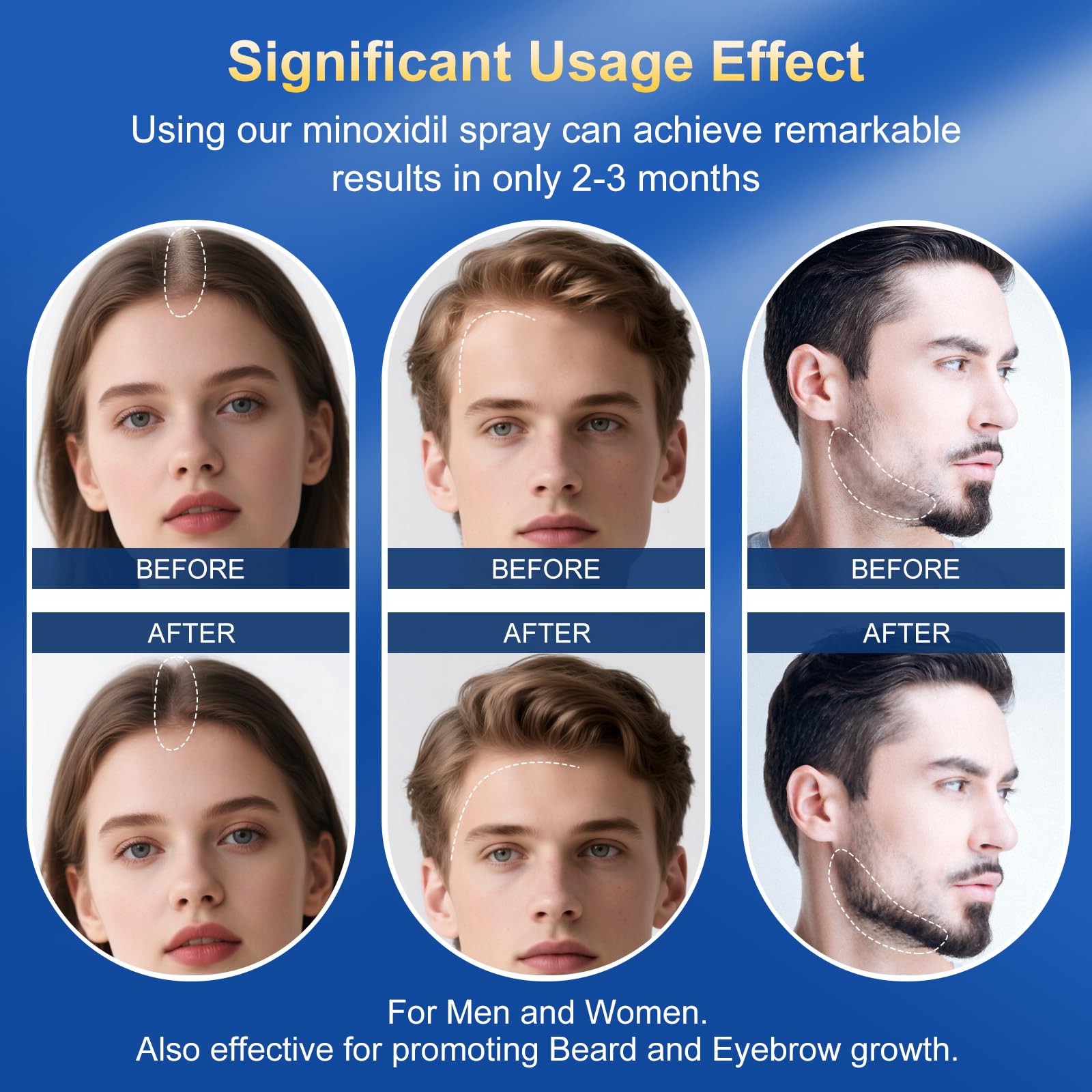 Trzsfr 5% Minoxidil Spray for Hair Growth — Extra Strength with Biotin | 12-Month 8-Pack (28 fl oz)