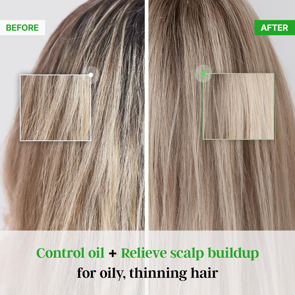 TS SHAMPOO Plus Biotin – Hair Loss Prevention & Damaged Hair Therapy (16.9 fl oz)