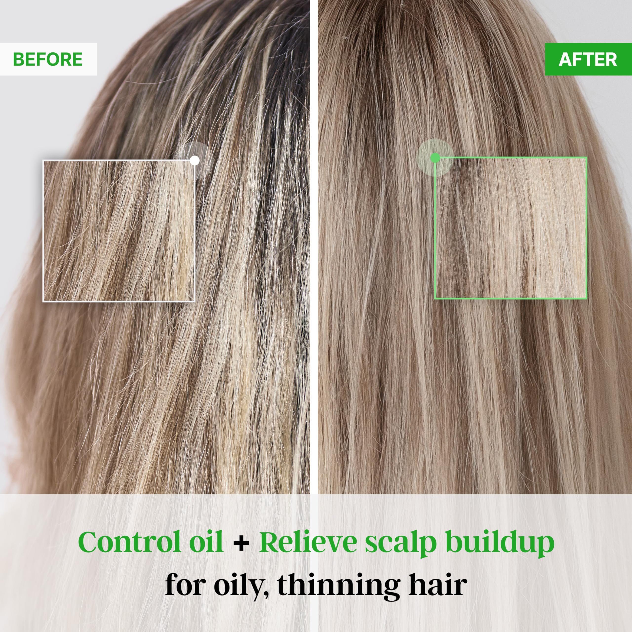 TS SHAMPOO Plus Biotin – Hair Loss Prevention & Damaged Hair Therapy (16.9 fl oz)