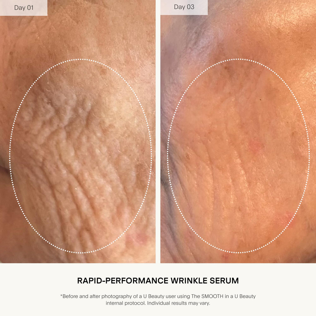 U Beauty The SMOOTH Dynamic Wrinkle Defense Serum – Multi-Peptide Complex