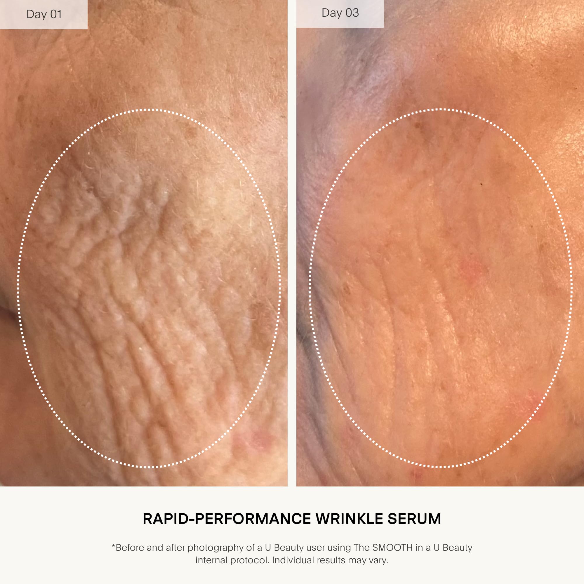 U Beauty The SMOOTH Dynamic Wrinkle Defense Serum – Multi-Peptide Complex