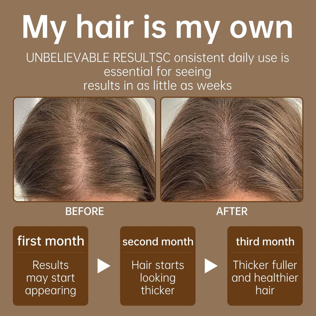 UIZELTA Batana Oil for Hair Growth – 100% Pure, Cold-Pressed, All Hair Types