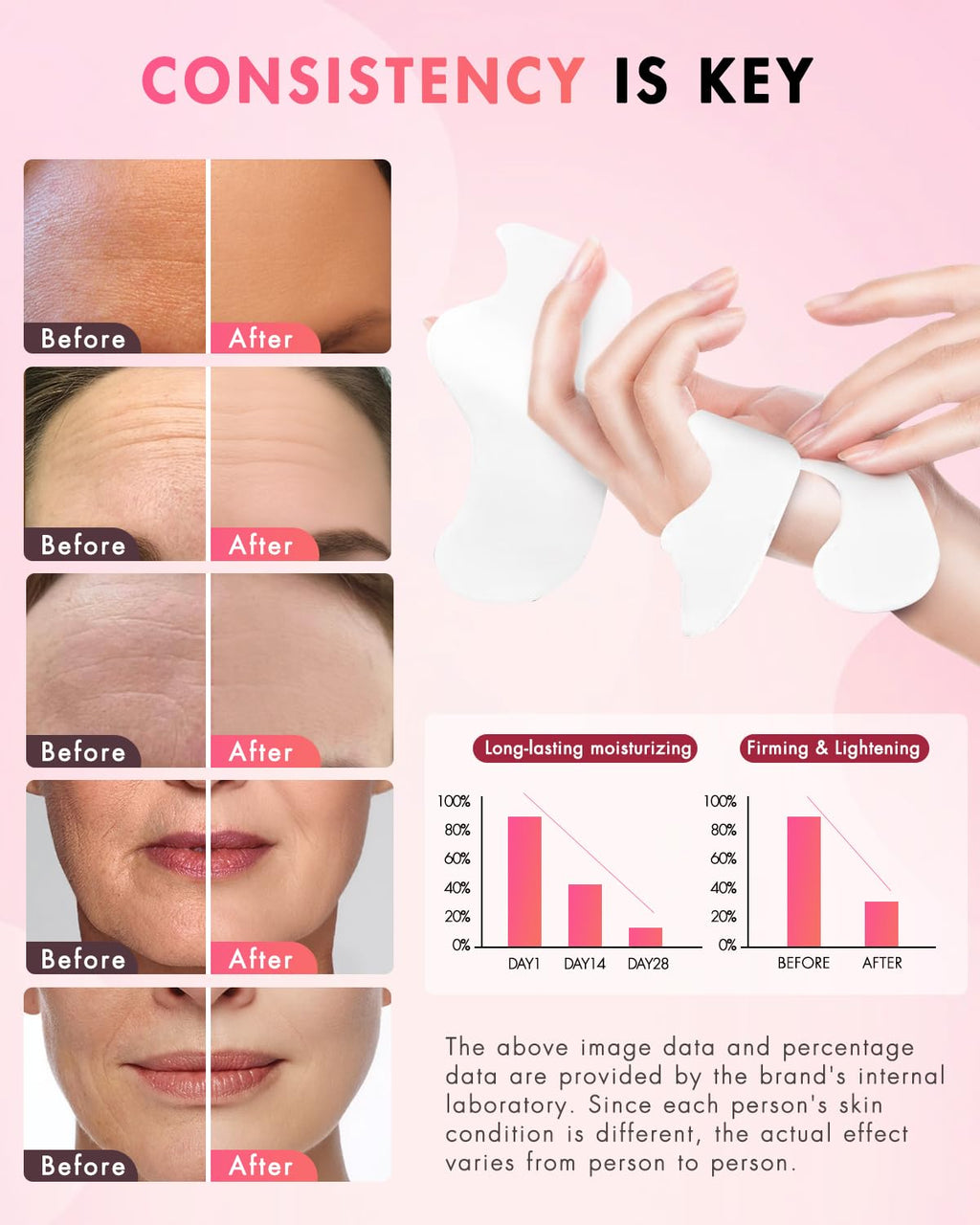 UKVOA Facial Forehead & Smile Line Patches – Overnight Hydration (36 pcs)