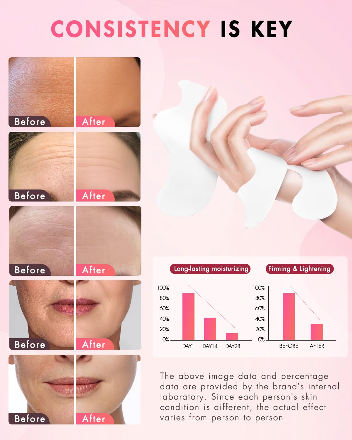 UKVOA Forehead Wrinkle Patches & Smile Line Patches – Overnight Hydration & Subtle Lift