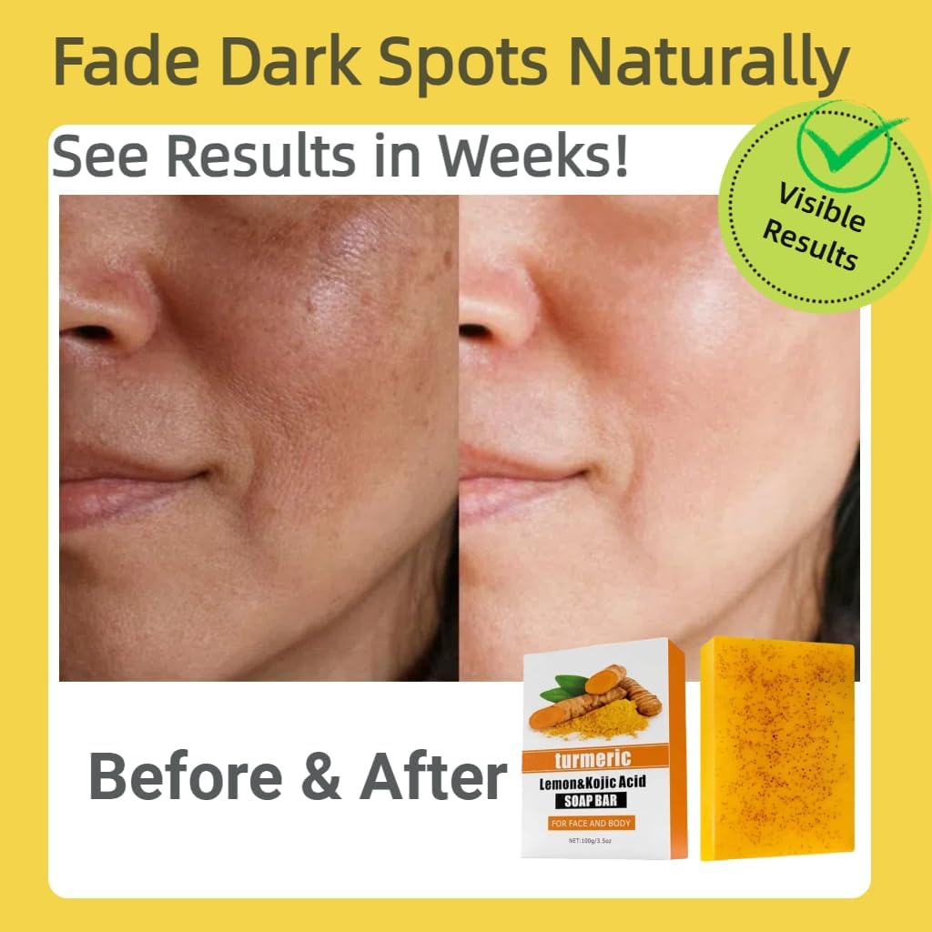 Uselective 3 Pack Lemon & Turmeric Soap Bar with Kojic Acid & Vitamin C – Deep Hydration