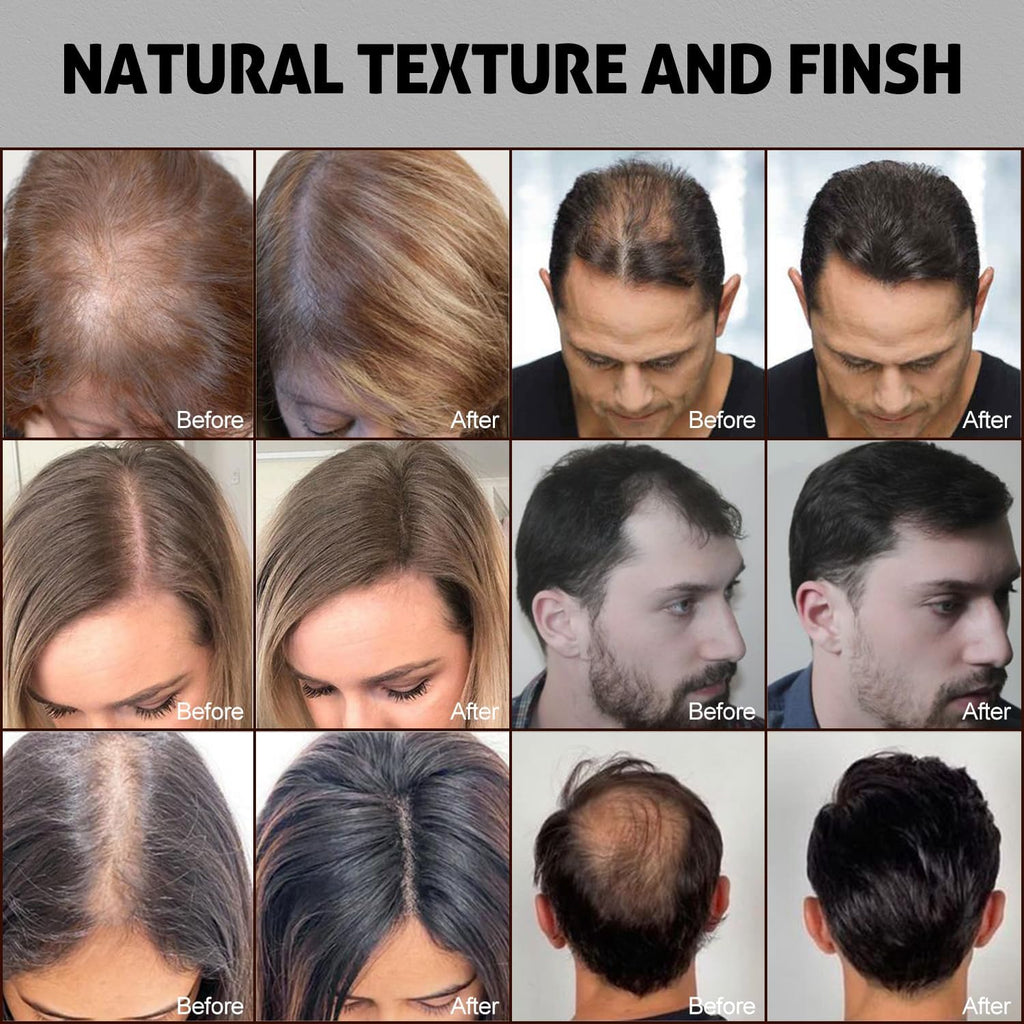 USTAR Hair Fibers 55g - Hair Building Fibers for Thinning Hair - Instantly Fuller Look - For Men & Women - Black