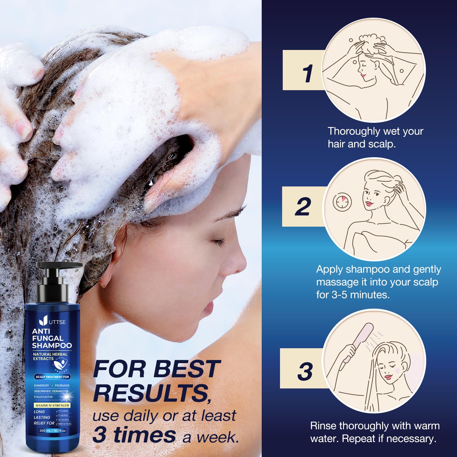 Uttse Anti-Fungal Shampoo for Scalp Psoriasis, Dandruff & Folliculitis — 300 mL