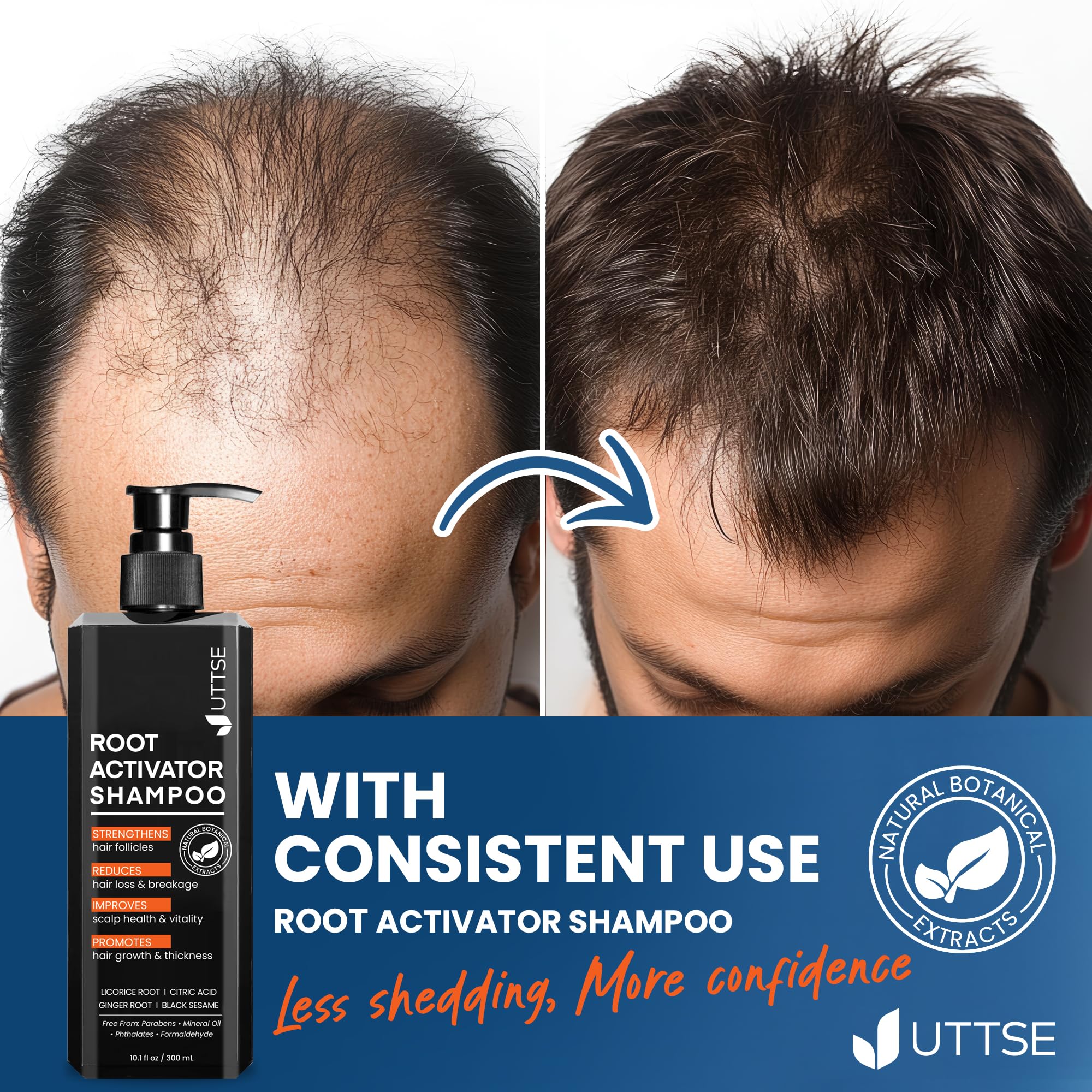 Uttse Root Activator Shampoo for Men – Hair Growth & Thicker Hair (300 mL)