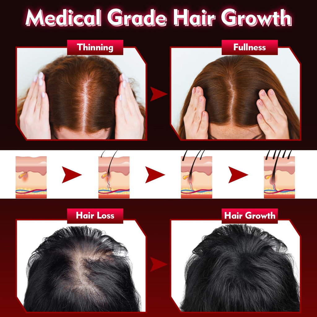 UUPAS Hair Growth Device – FDA Cleared Laser Red Light Therapy Cap for Hair Regrowth