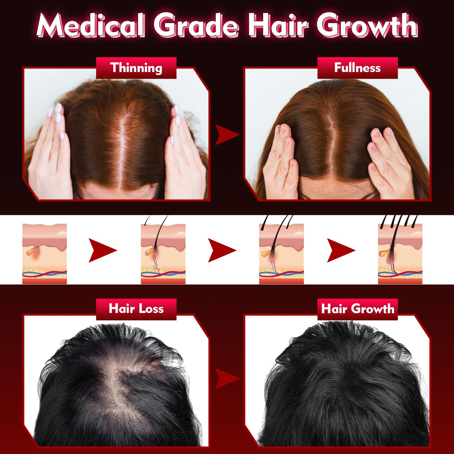 UUPAS Hair Growth Device – FDA Cleared Laser Red Light Therapy Cap for Hair Regrowth