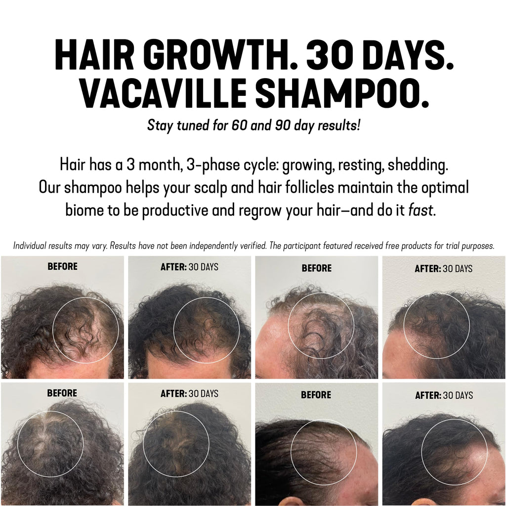 Vacaville Beauty Mini Shampoo Gift Set: Peppermint Powder Shampoo & Conditioner for All Hair Types - Vegan, Eco-Friendly, Cruelty-Free - Botanical Ingredients Clinically Proven to Promote Hair Growth