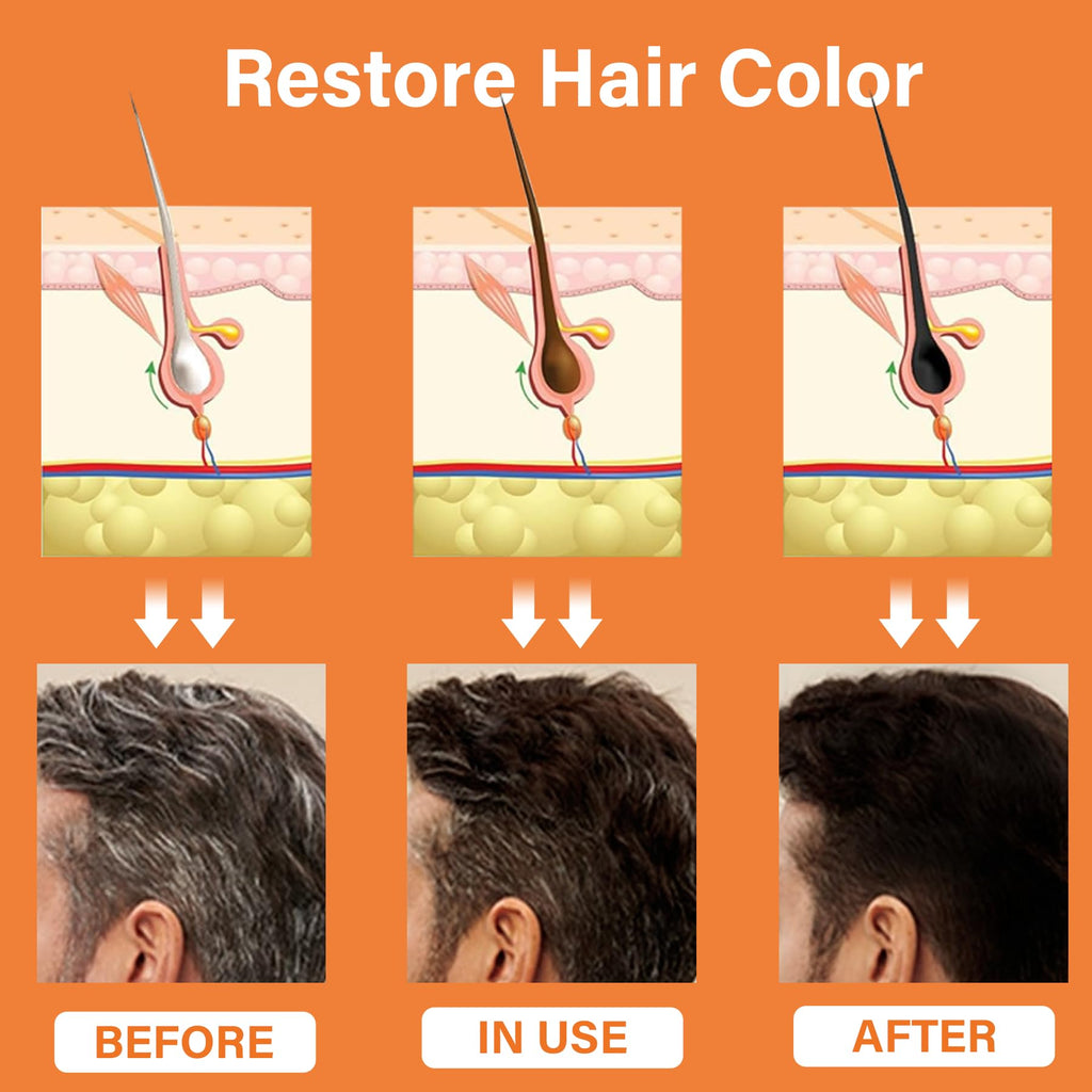 VAEYAE Herbal Gray Hair Reverse Spray - Darkening and Growth Support for Thinning Hair