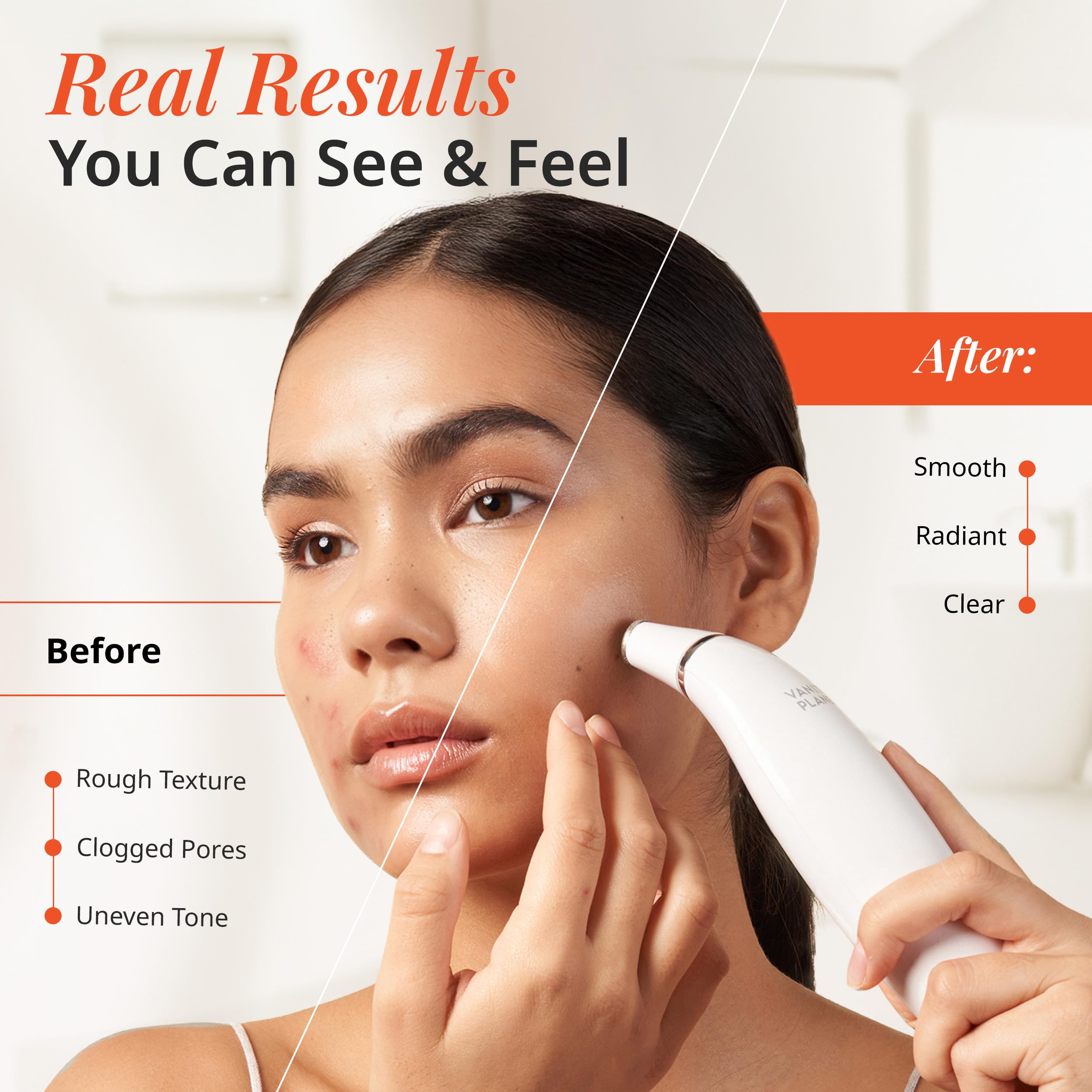 Exfora Facial Microdermabrasion Wand by Vanity Planet | 4 Interchangeable Heads, Dual Charging