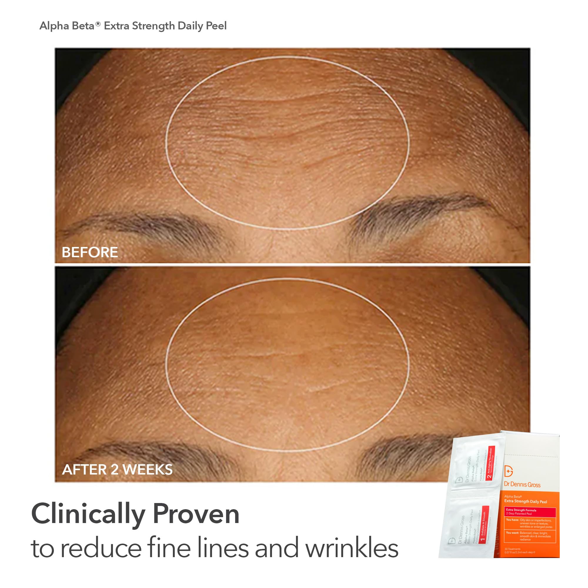 Dr Dennis Gross Peel Vault Kit – 90 Treatments (30 Alpha Beta Extra Strength + 60 Universal) | Limited Edition