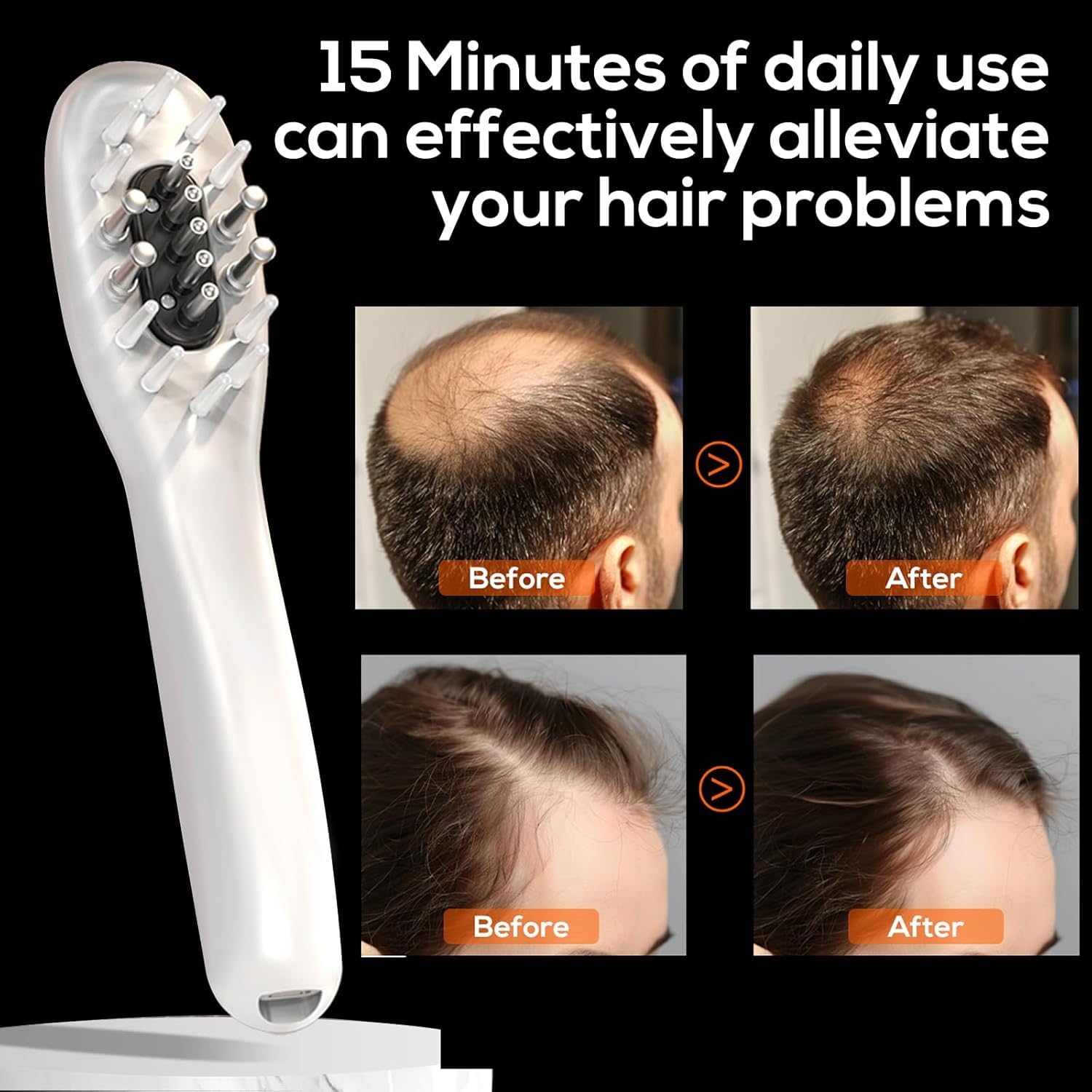 Vavis Lasercomb-001: Laser Therapy Hair Growth Comb for Women & Men