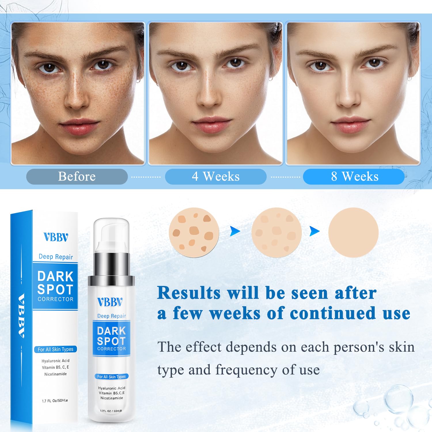 VBBV Dark Spot Remover for Face & Body – Hyperpigmentation Corrector, 1.7 oz