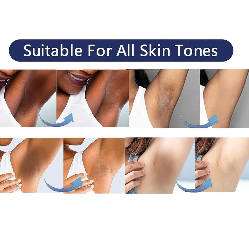 Vcetree Skin Bleaching Cream for Intimate Areas | Gentle Lightening & Even Tone (1 oz)