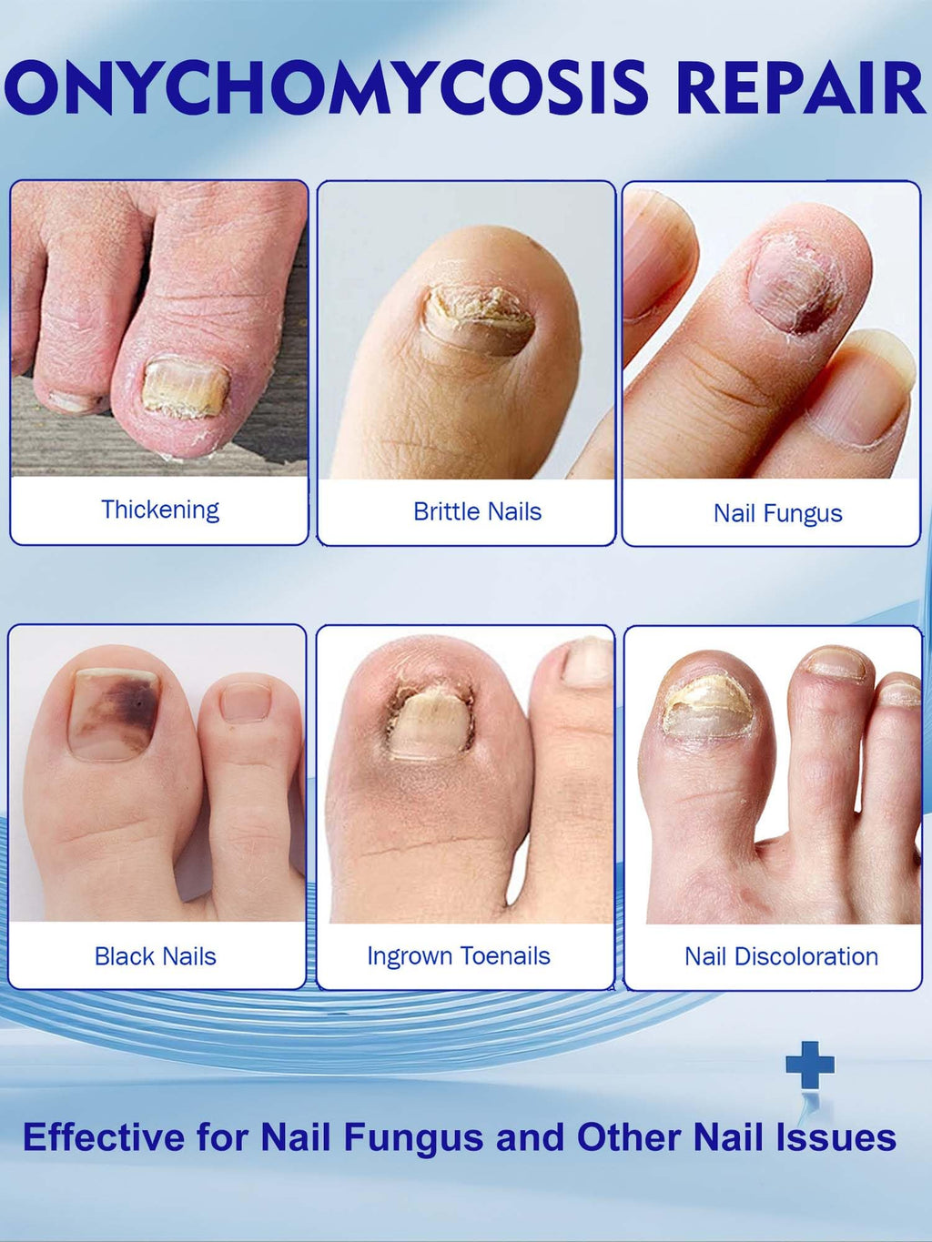 Vealvion Nail Patches — Extra Strength Overnight Nail Repair (8-Hour)