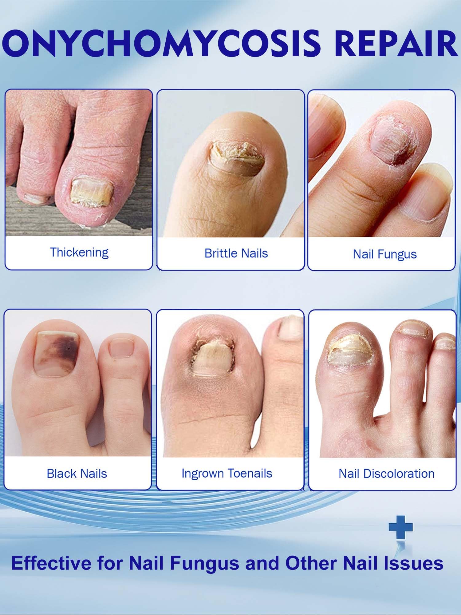 Vealvion Nail Patches — Extra Strength Overnight Nail Repair (8-Hour)