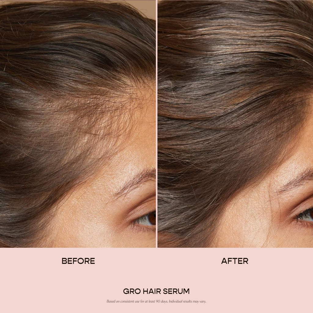 VEGAMOUR GRO Hair Serum for Thinning Hair – Thicker, Fuller-Looking Hair | 1.0 fl oz