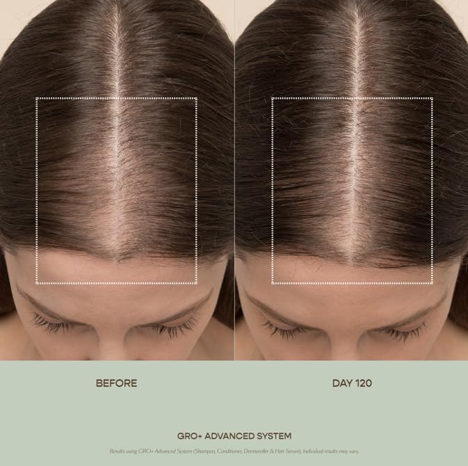VEGAMOUR GRO+ Advanced Hair Serum 3-Pack – Improve Density, Reduce Shedding, Healthy Scalp