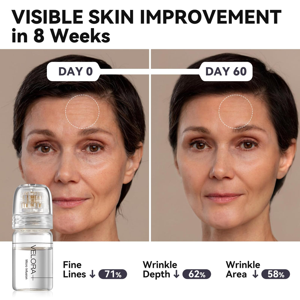 VELORA Micro Infusion System for Face – Hydrating Peptide & Hyaluronic Acid Serum Set