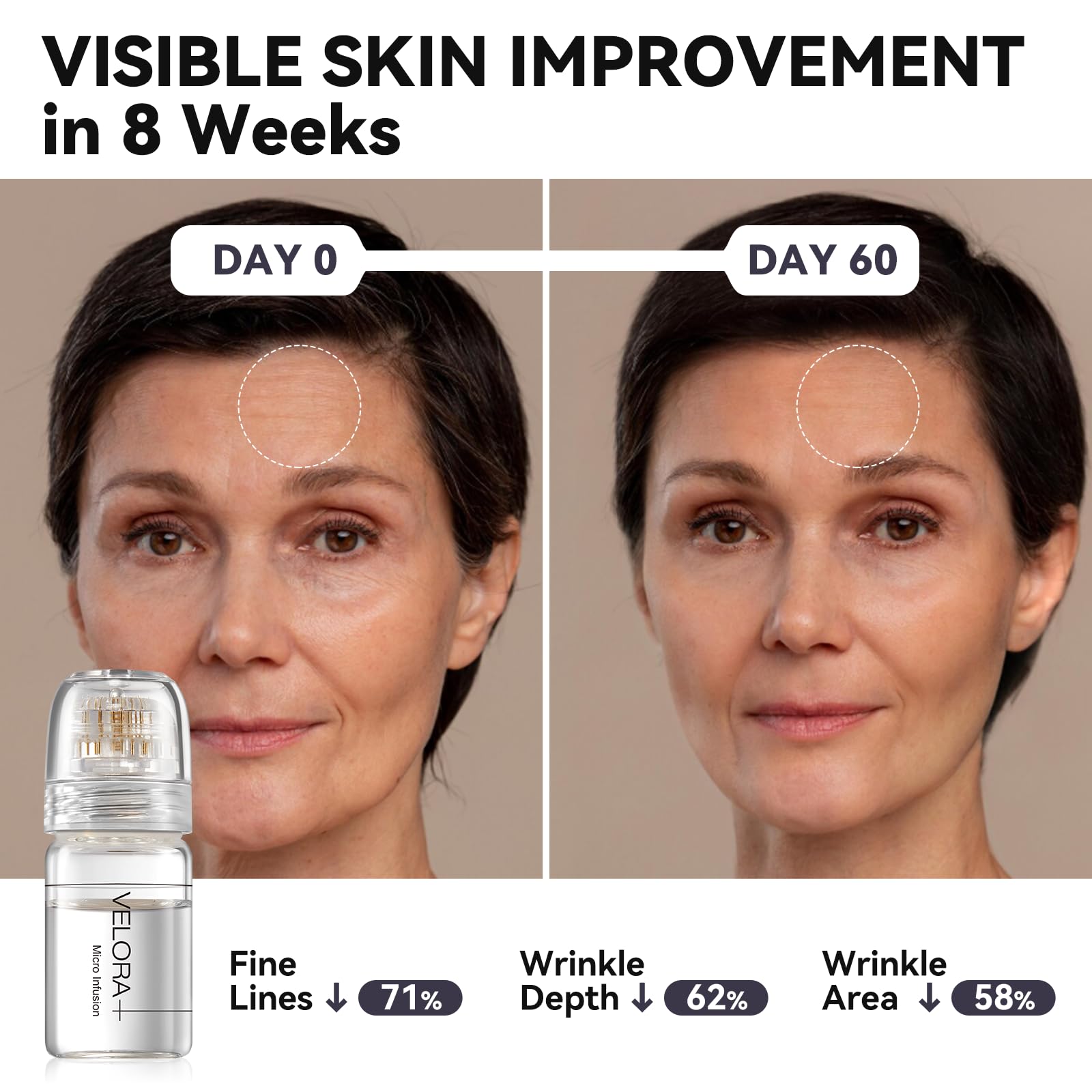 VELORA Micro Infusion System for Face – Hydrating Peptide & Hyaluronic Acid Serum Set