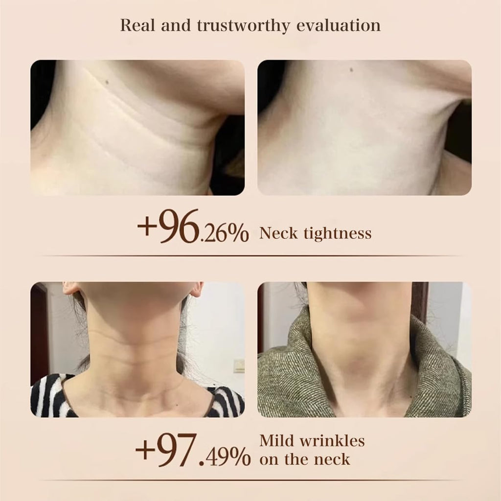 Venrock Anti-Aging Neck Cream with Niacinamide & Hyaluronic Acid – Hydrating Day & Night Neck & Décolleté Cream, 1.76 oz