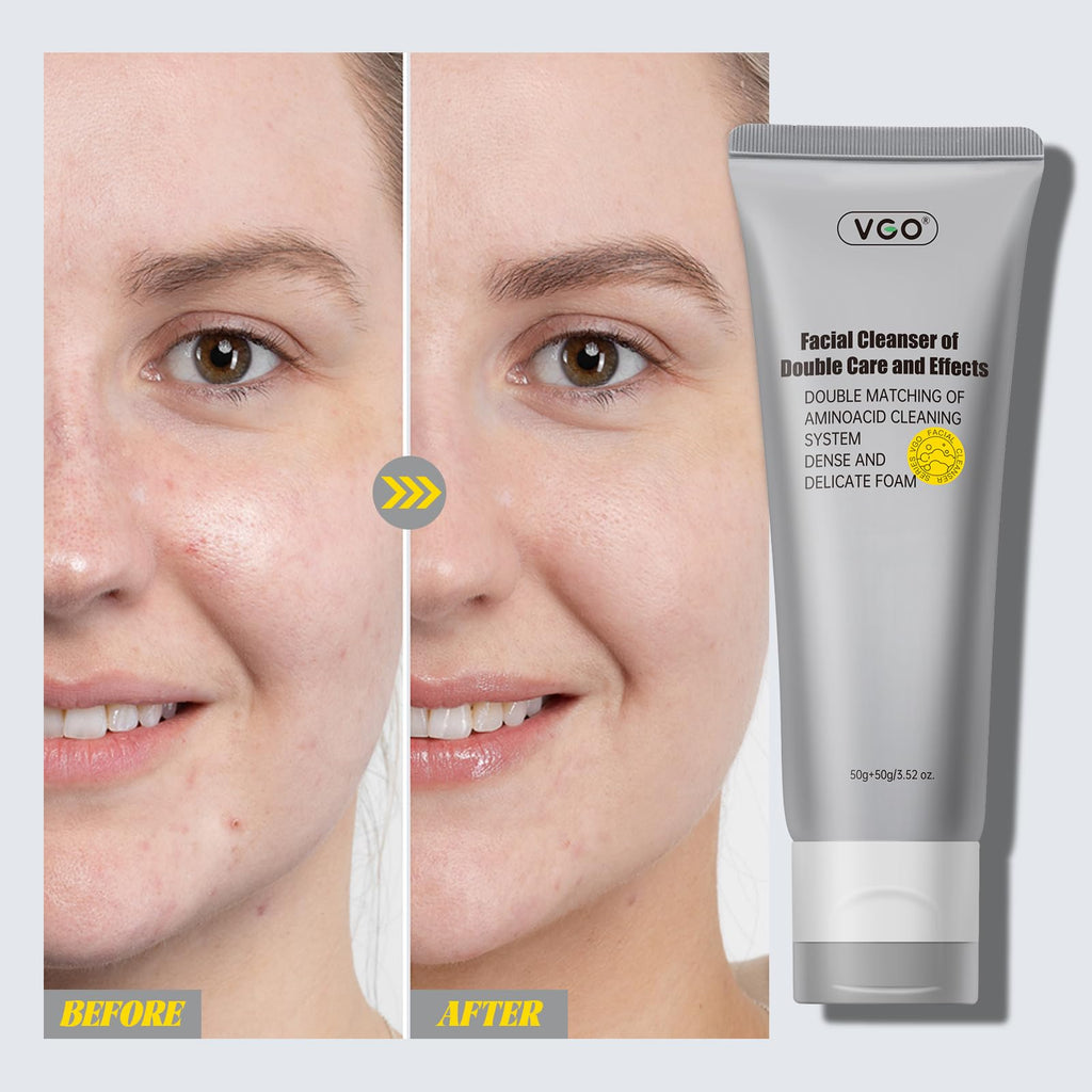 VGO Facial Cleanser – Dual-Tube 3-in-1 Cleanser with Amino Acids & Mud, 3.52 oz