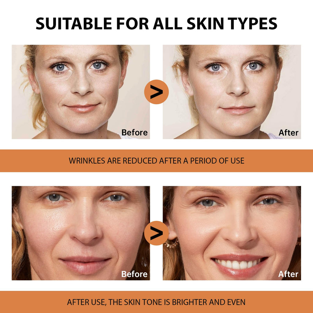 VGO 2 Pack Vitamin C Face Serum – Deep Hydration, Radiance & Even Tone