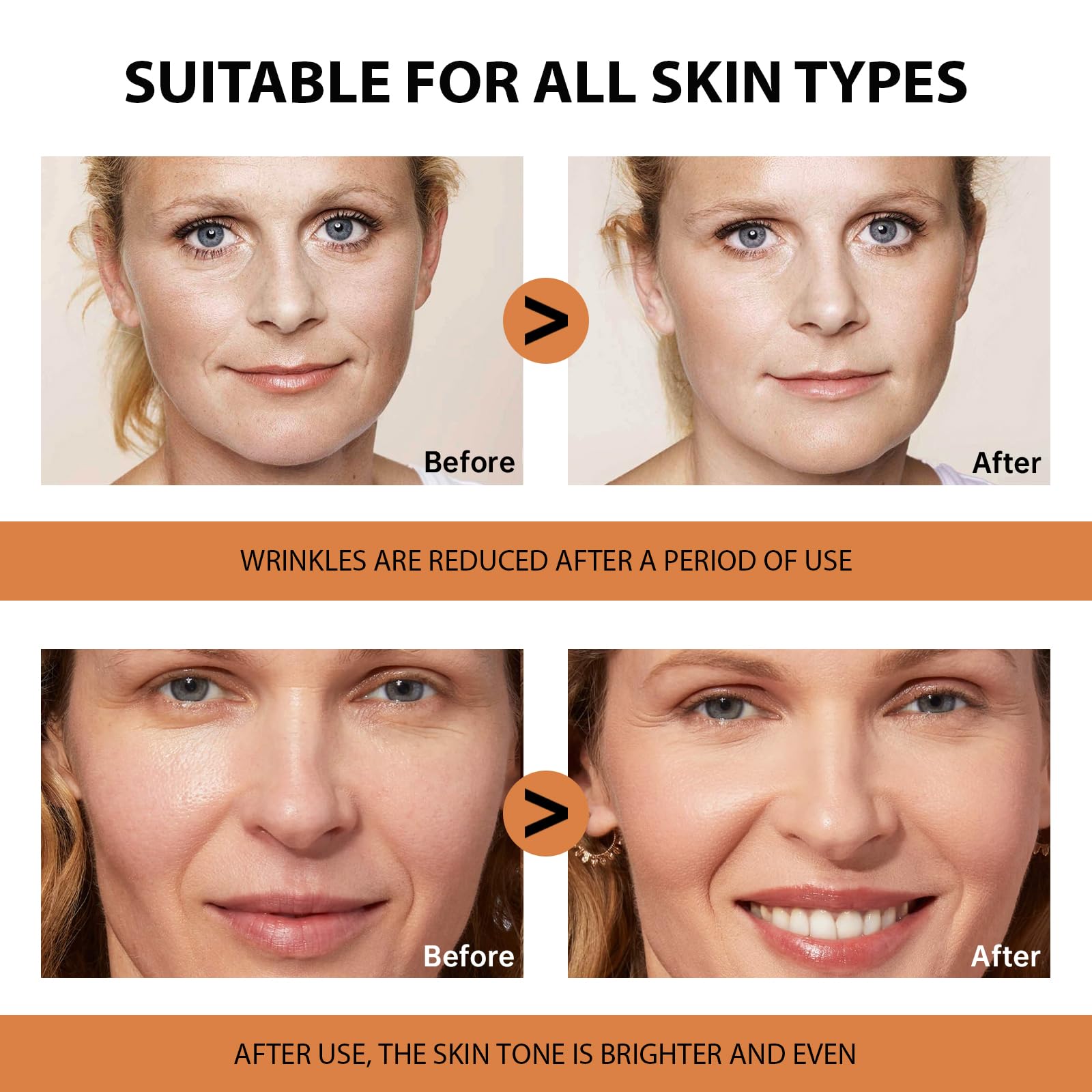 VGO 2 Pack Vitamin C Face Serum – Deep Hydration, Radiance & Even Tone