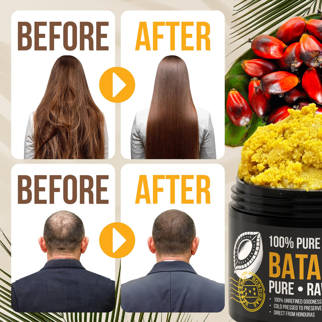 Vie Naturelle Batana Oil – Hair Growth from Honduras, Raw Unrefined, Cold-Pressed, 4 oz