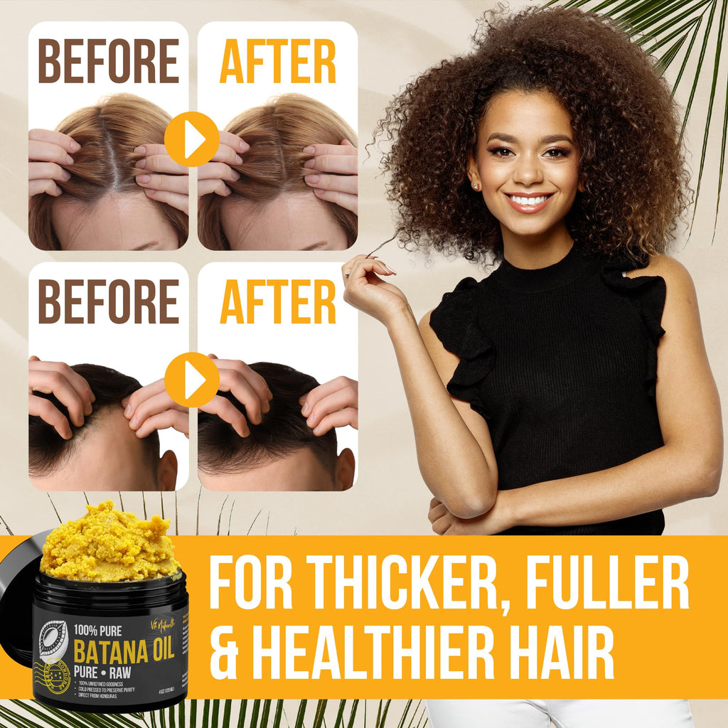 Vie Naturelle Batana Oil – Hair Growth from Honduras, Raw Unrefined, Cold-Pressed, 4 oz