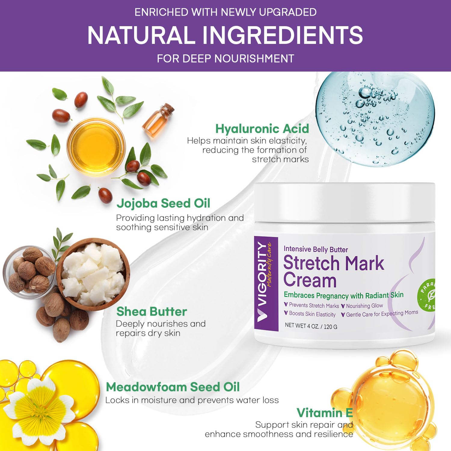 Vigority Stretch Mark Cream for Pregnancy – Belly Butter for Expecting Moms, 4 oz