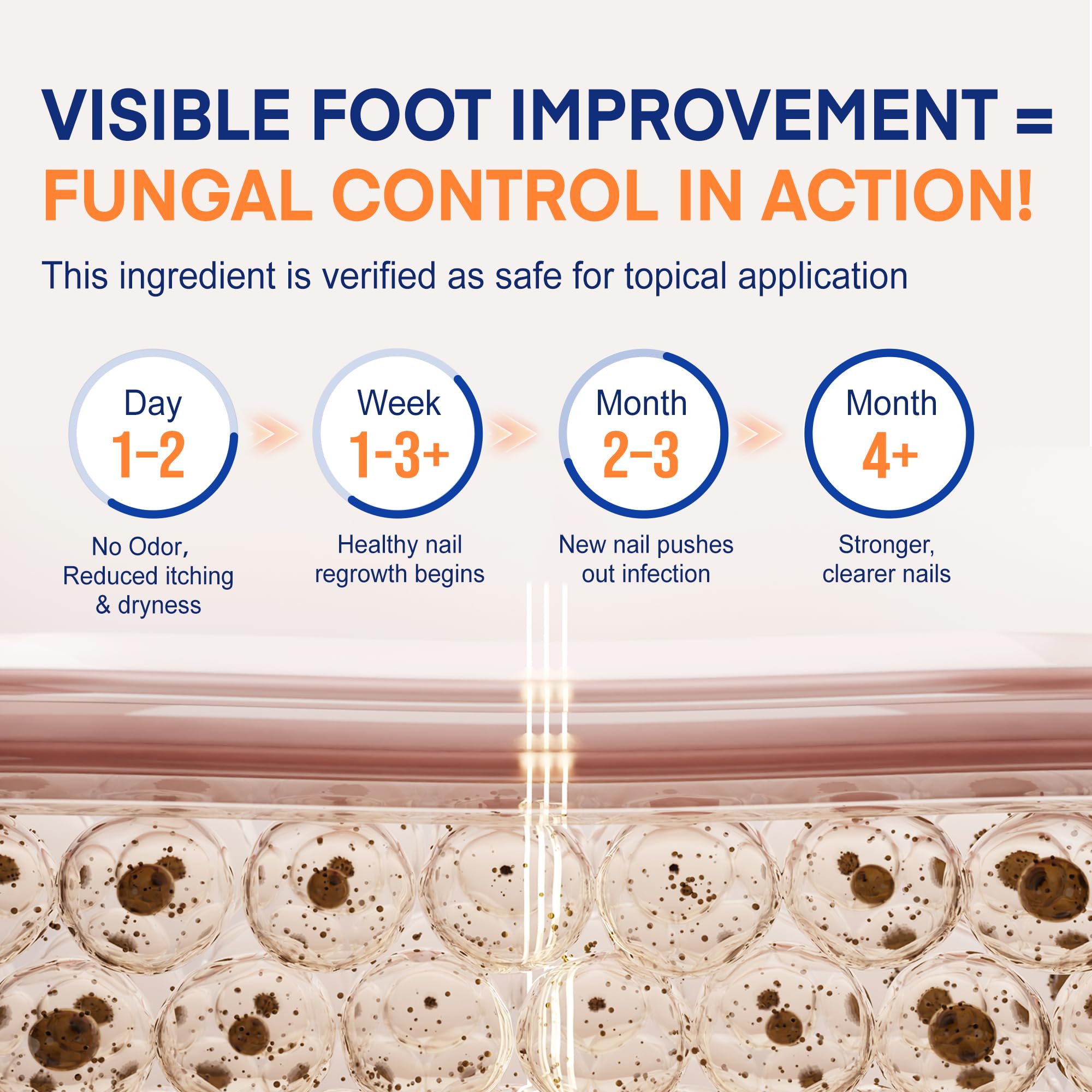 VigorWell Toenail Treatment Extra Strength – Dual Action Nail Repair Kit (30 ml Gel + 32 Patches)